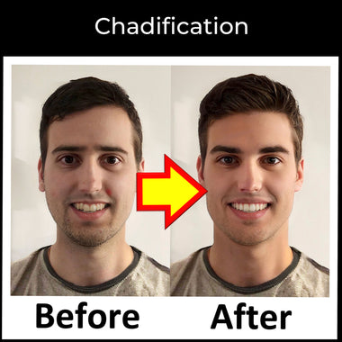 Before and after image of a man undergoing Chadification, highlighting improvements in jawline, midface structure, eye area, and overall facial health.