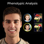 Facial Analysis, Looksmaxxing