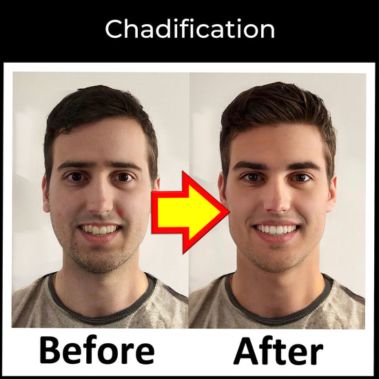 Before and after image of a man undergoing Chadification, highlighting improvements in jawline, midface structure, eye area, and overall facial health.